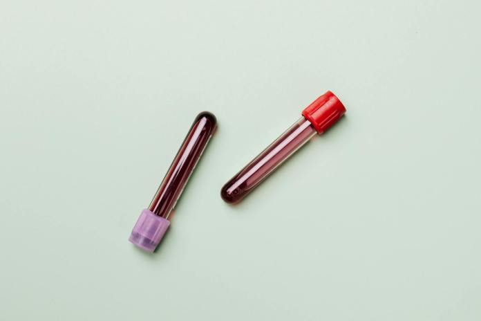 blood samples